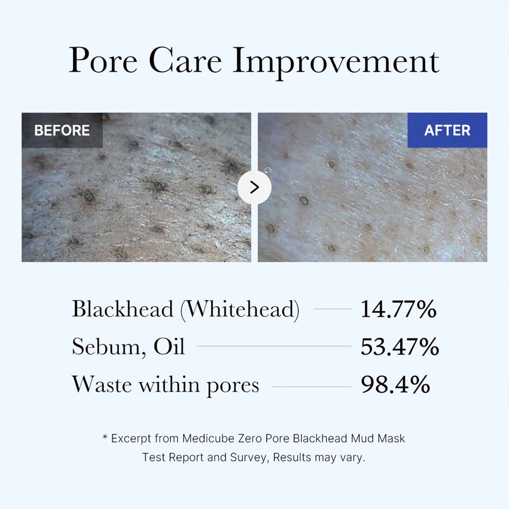 medicube Zero Pore Blackhead Mud Mask 100g